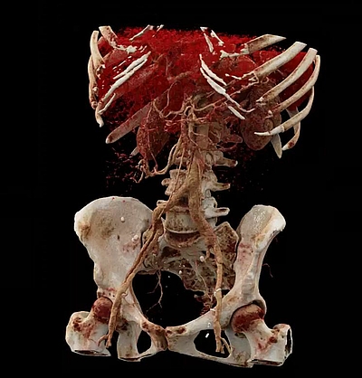 Die moderne Bildgebung (Radiologietechnologie) von heute ermöglicht es, das Innere des menschlichen Körpers bis in kleinste Strukturen darzustellen. © FH Gesundheitsberufe 