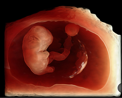 Embrio - 7 Wochen
