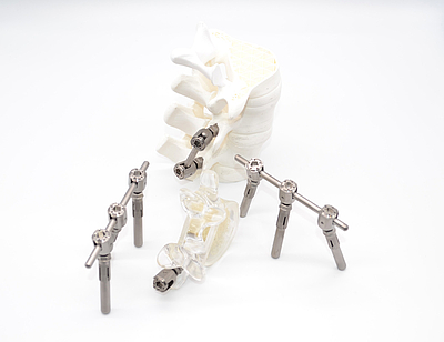 Hyper Spine Insert Dowel – Wirbelsäulenstabilisierungssystem © V.I.E. Systems GmbH